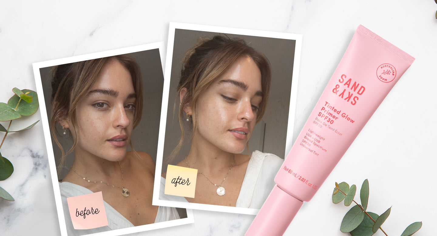 Sun’s Out, Skin’s In: 5 Reasons Sunscreen is Your Skin’s Best Friend