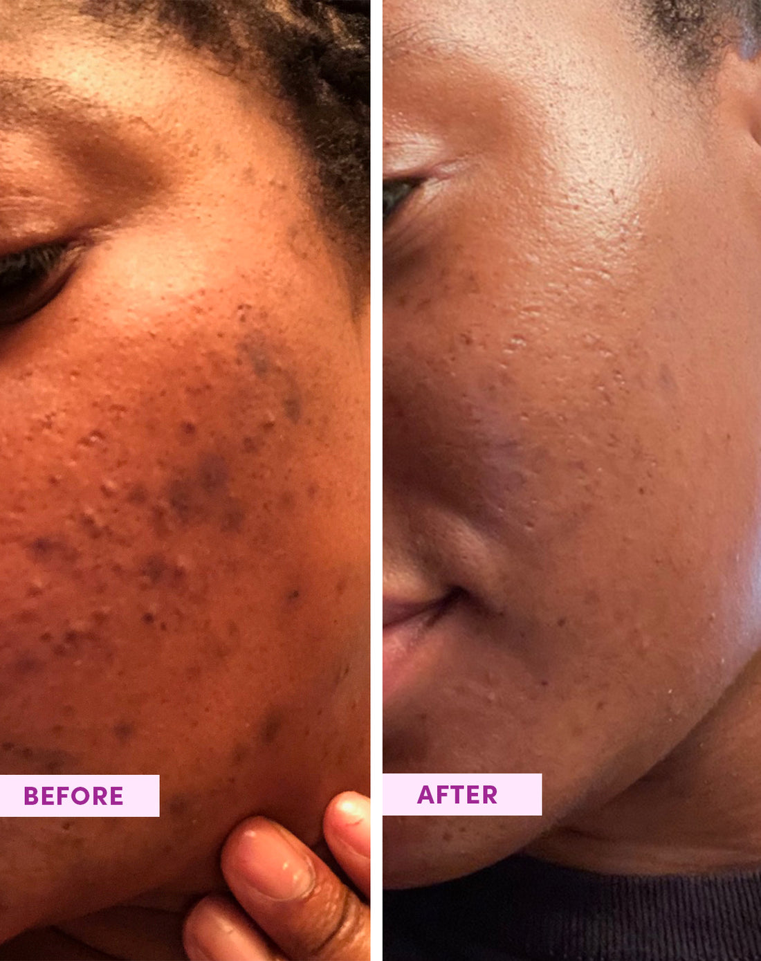 Nahaufnahme der Textur und Konsistenz des Australian Glow Berries Enzym-Peeling-Puders von SandSky