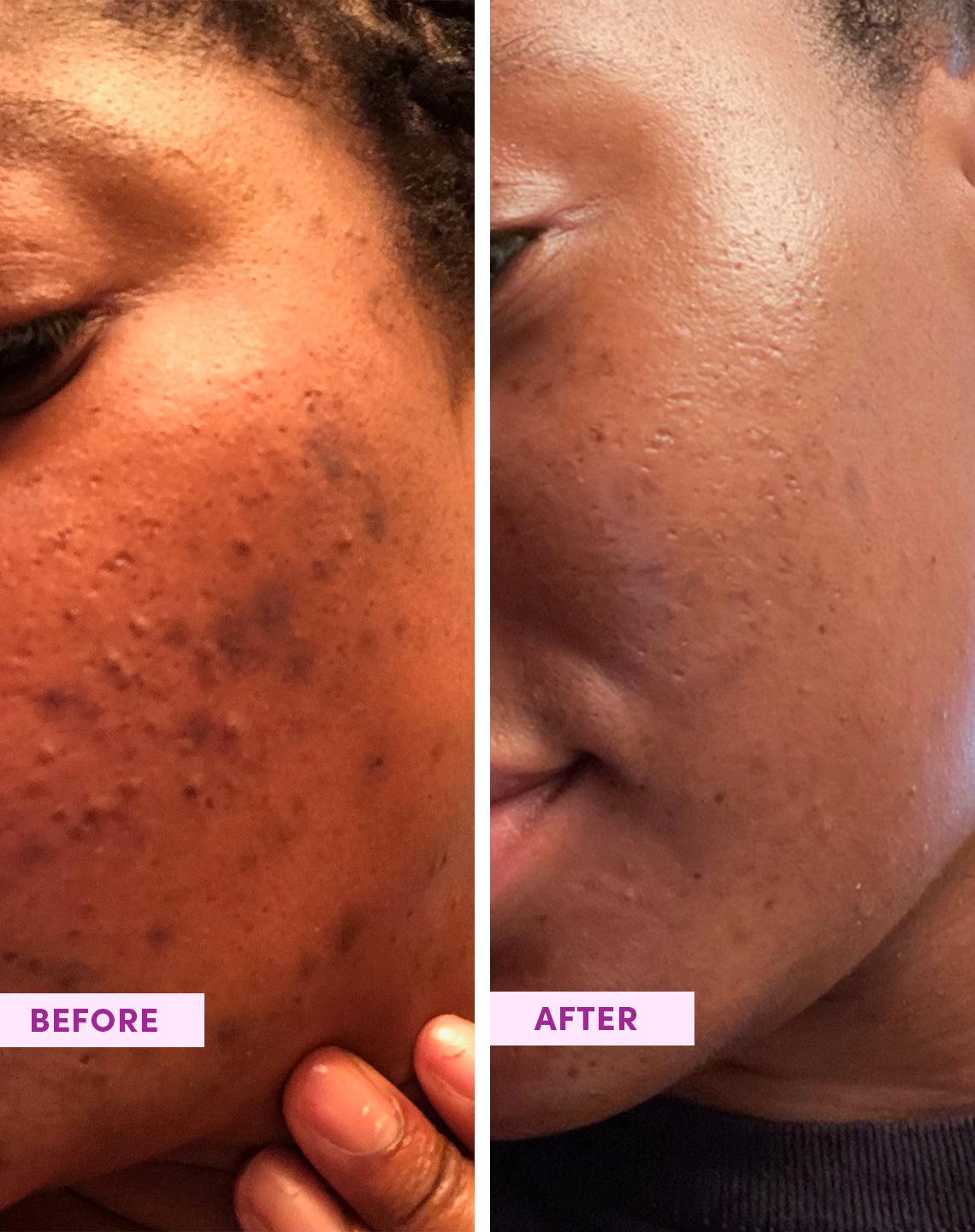 Nahaufnahme der Textur und Konsistenz des Australian Glow Berries Enzym-Peeling-Puders von SandSky