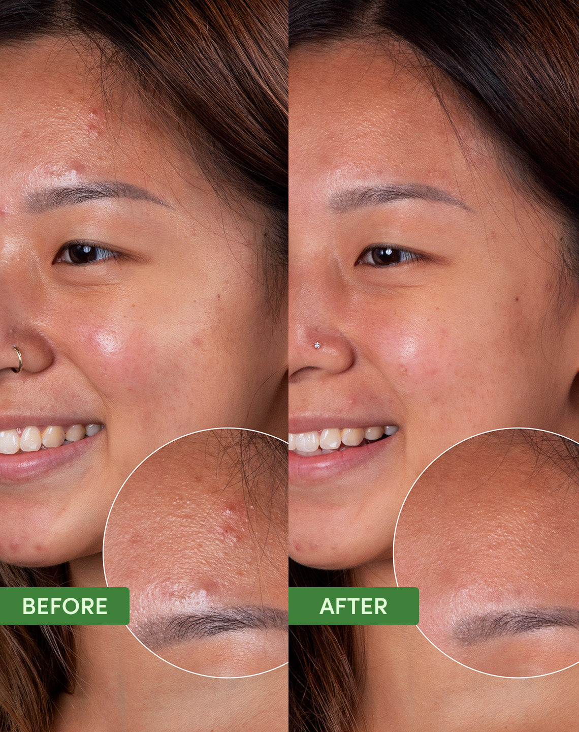 Oil Control Clearing Cleanser gel texture - deep cleansing formula for oily acne-prone skin