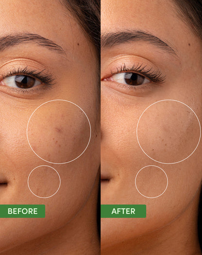 Oil Control Clearing Moisturizer texture and consistency closeup