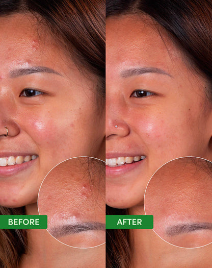 Clean Sweep Kit – Produktdetails der Verpackung