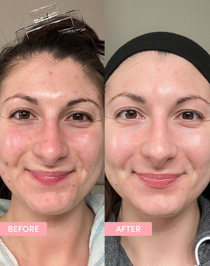 Baby Skin Duo - product packaging details