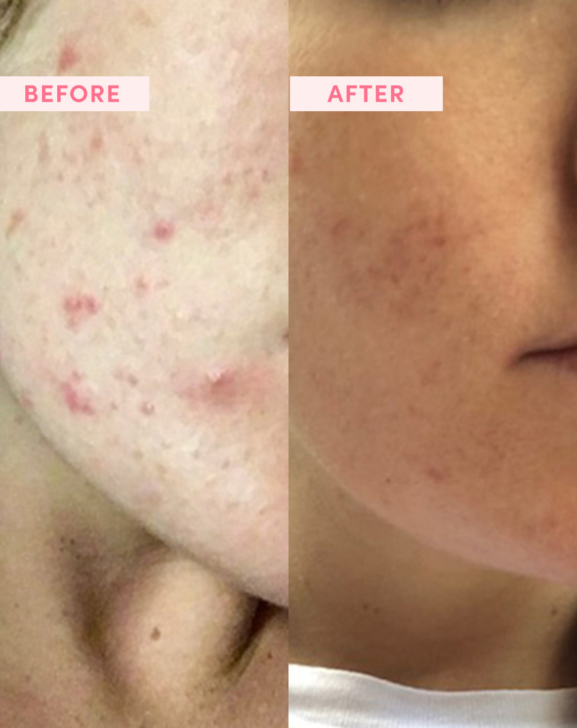 Anwendung des SandSky Australian Pink Clay Perfect Skin Kits – Gebrauchsanweisung